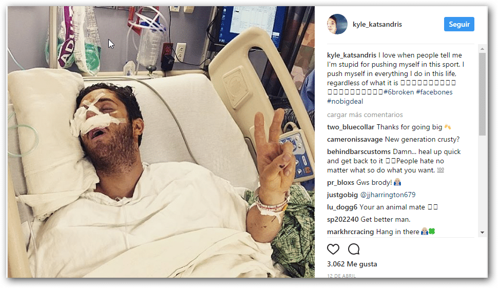 El freestyler Kyle Katsandris sufre un aparatoso accidente. 3 acci